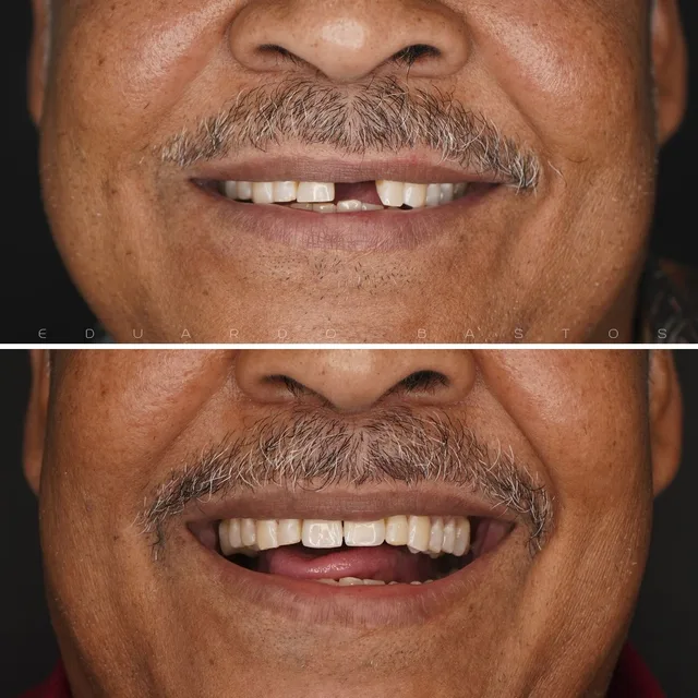 Before and after dental transformation 3